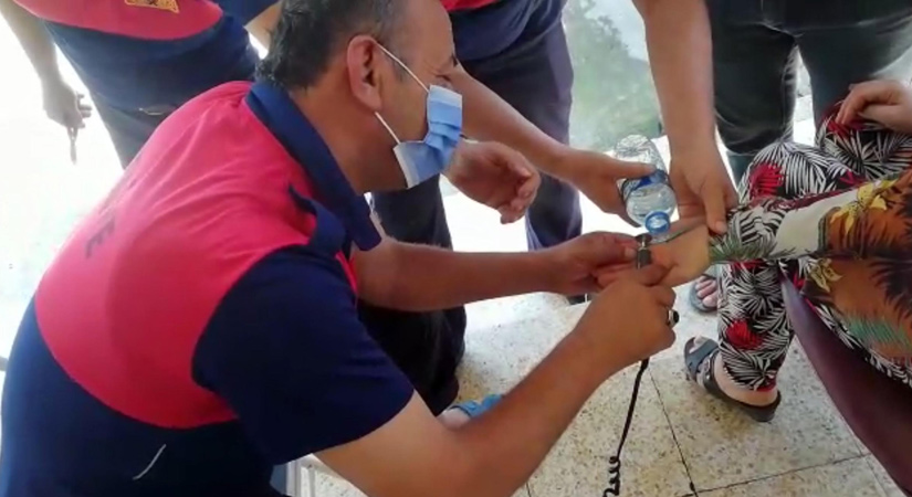 Parmağa sıkışan yüzük itfaiye ekipleri tarafından kesildi